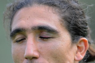 Juan Castillo a la orden, con un derrame en un ojo, por el pelotazo recibido el martes. 