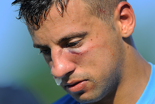 Emiliano Díaz, el día que se rompió el tabique nasal ante Nacional en Colonia. Foto de Fernando González.