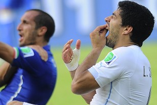 Esta es la fotografía inmediata al choque entre el zaguero italiano Giorgio Chiellini y Luis Suárez. El Bombardero se toma la boca en claras muestras de dolor por el choque de su cara con el hombre del gigante italiano quién se toma el hombro con su mano derecha.