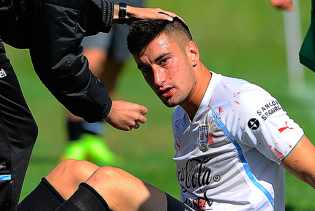 Erick Cabaco terminó el juego con un corte. 